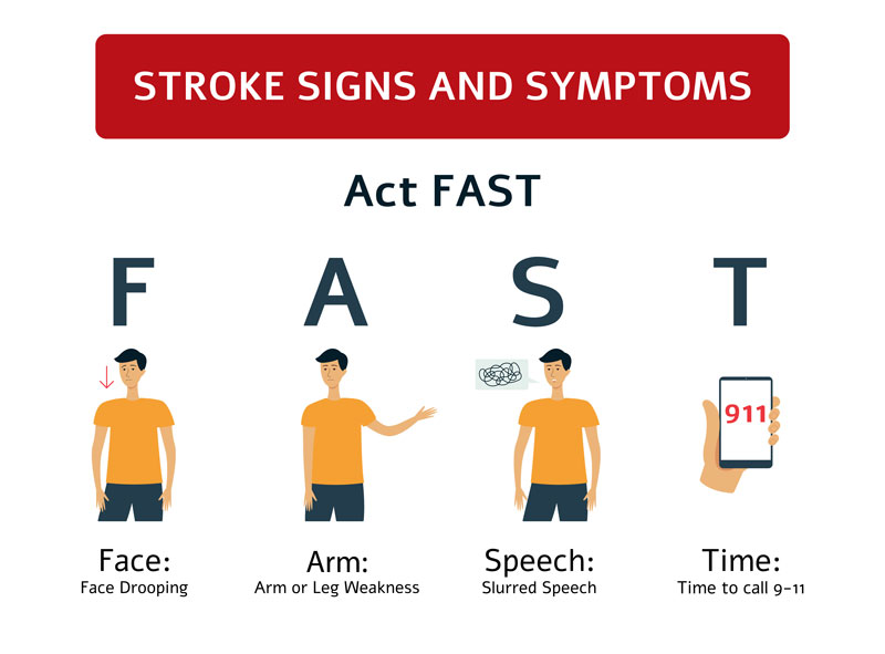 Stroke Symptoms: From FAST to FASTER